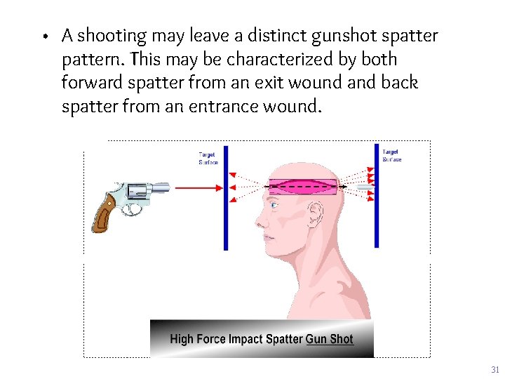  • A shooting may leave a distinct gunshot spattern. This may be characterized