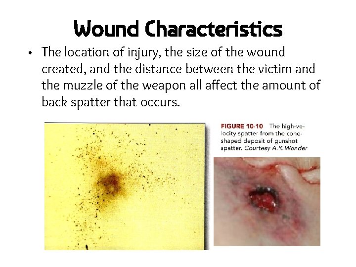 Wound Characteristics • The location of injury, the size of the wound created, and