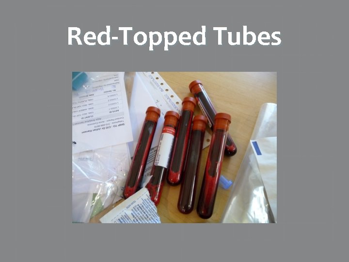 Red-Topped Tubes 
