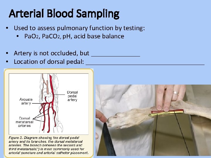 Arterial Blood Sampling • Used to assess pulmonary function by testing: • Pa. O