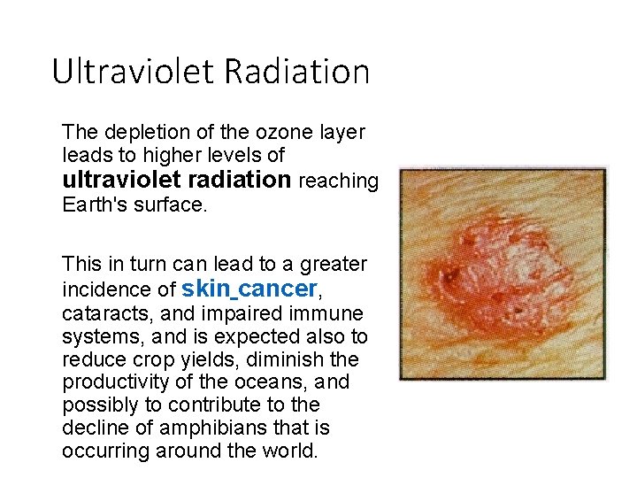 Ultraviolet Radiation The depletion of the ozone layer leads to higher levels of ultraviolet