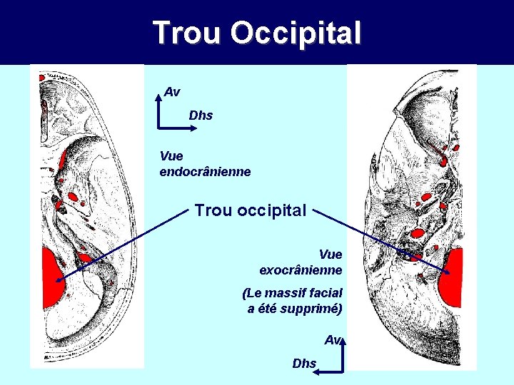 Trou Occipital Av Dhs Vue endocrânienne Trou occipital Vue exocrânienne (Le massif facial a