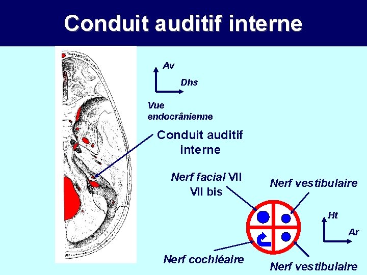 Conduit auditif interne Av Dhs Vue endocrânienne Conduit auditif interne Nerf facial VII bis