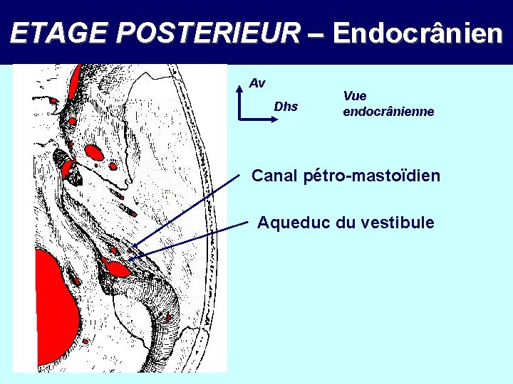 ETAGE POSTERIEUR – Endocrânien Av Dhs Vue endocrânienne Canal pétro-mastoïdien Aqueduc du vestibule 