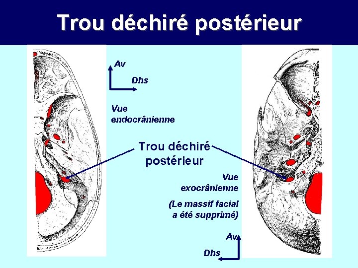 Trou déchiré postérieur Av Dhs Vue endocrânienne Trou déchiré postérieur Vue exocrânienne (Le massif