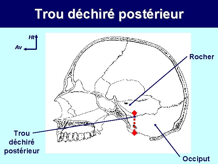 Trou déchiré postérieur Ht Av Rocher Trou déchiré postérieur Occiput 