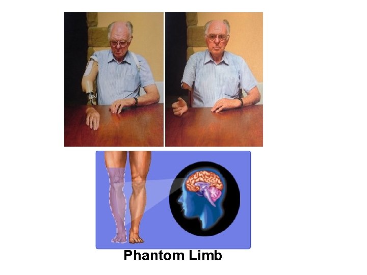 Phantom Limb 