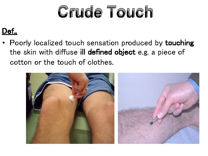 Crude Touch Def. , • Poorly localized touch sensation produced by touching the skin