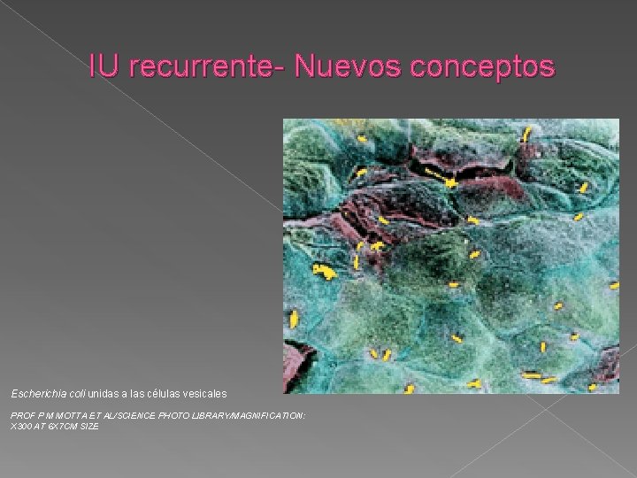 IU recurrente- Nuevos conceptos Escherichia coli unidas a las células vesicales PROF P M