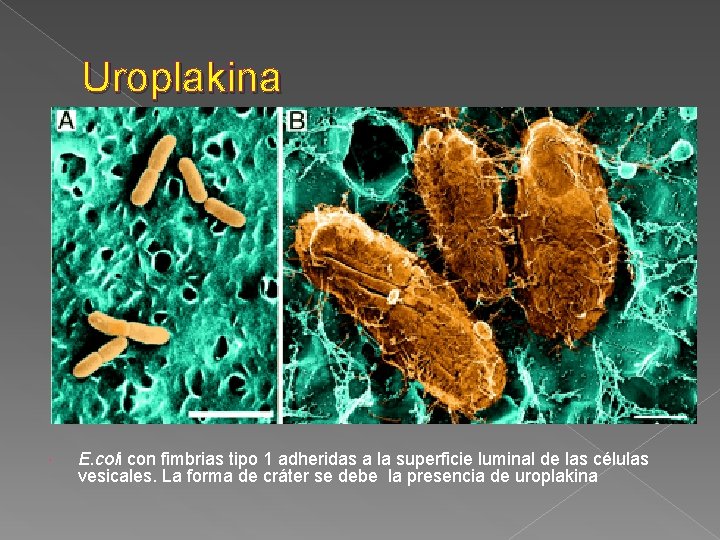 Uroplakina E. coli con fimbrias tipo 1 adheridas a la superficie luminal de las