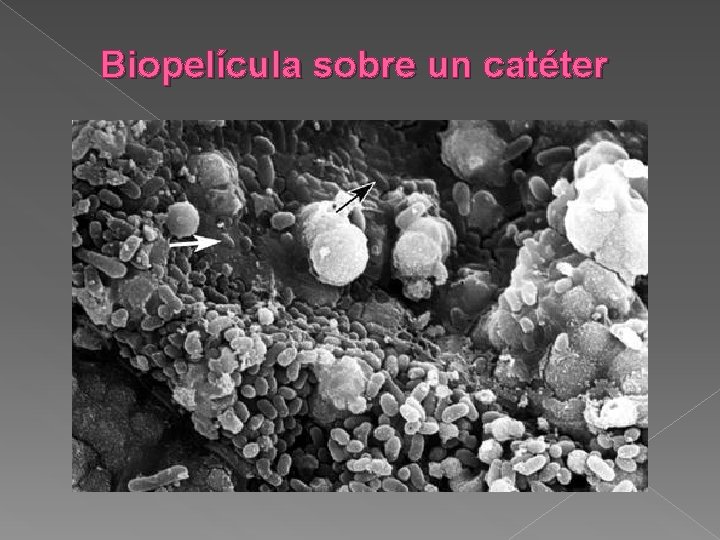 Biopelícula sobre un catéter 