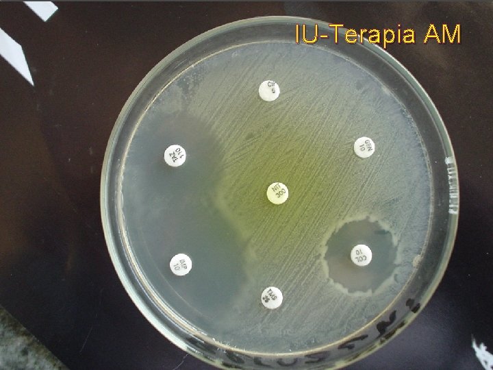 IU-Terapia AM 