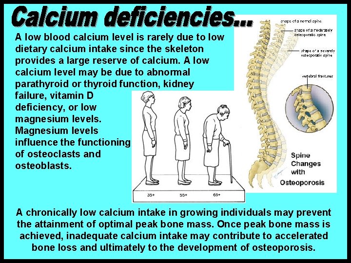 A low blood calcium level is rarely due to low dietary calcium intake since