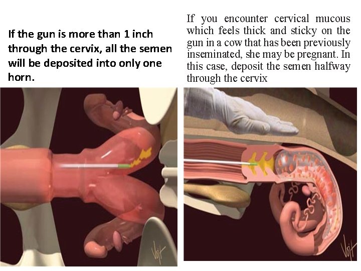 If the gun is more than 1 inch through the cervix, all the semen
