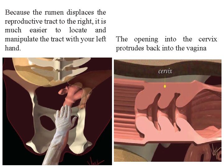 Because the rumen displaces the reproductive tract to the right, it is much easier