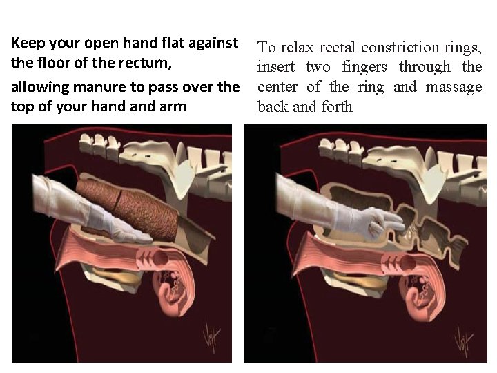 Keep your open hand flat against the floor of the rectum, allowing manure to