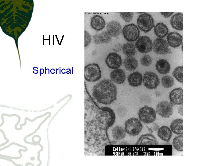 HIV Spherical 