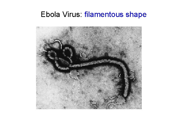 Ebola Virus: filamentous shape 