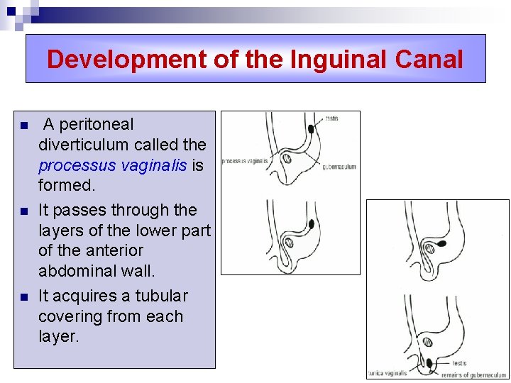 Development of the Inguinal Canal n n n A peritoneal diverticulum called the processus