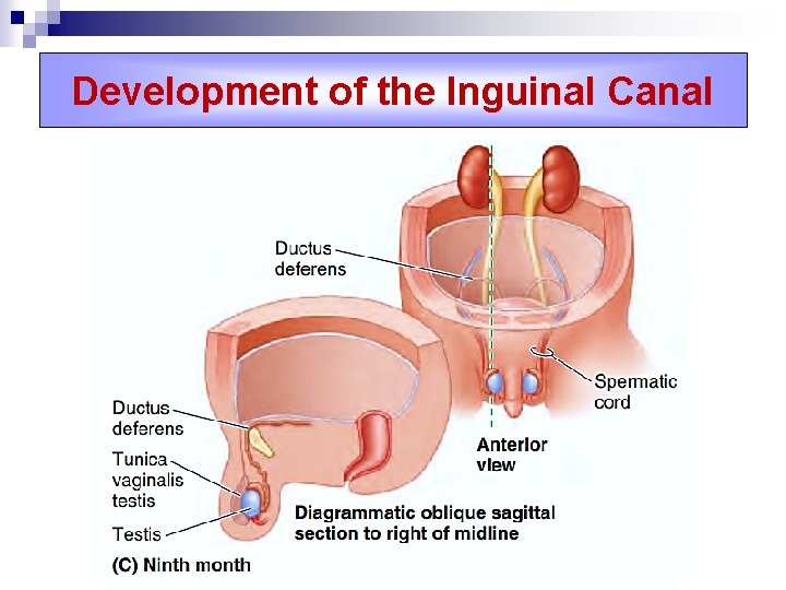 Development of the Inguinal Canal 