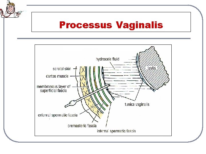 Processus Vaginalis 