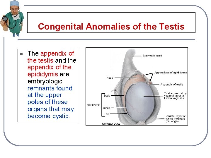 Congenital Anomalies of the Testis l The appendix of the testis and the appendix