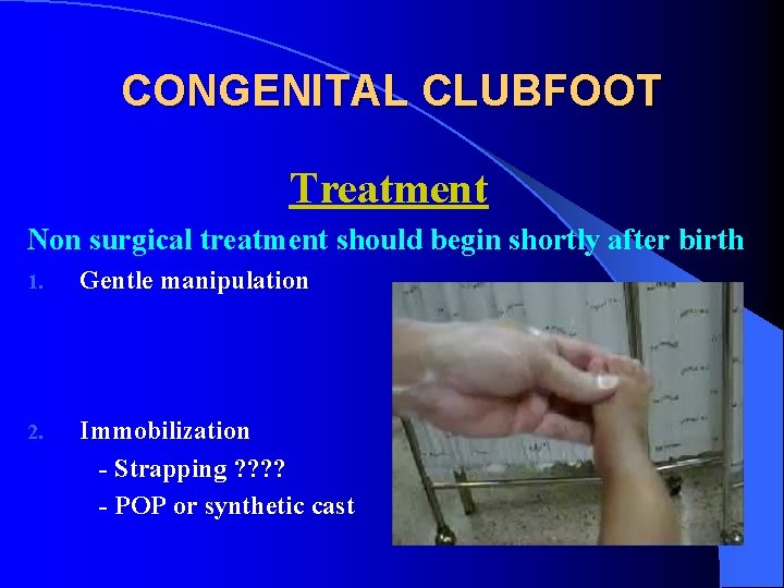 CONGENITAL CLUBFOOT Treatment Non surgical treatment should begin shortly after birth 1. Gentle manipulation