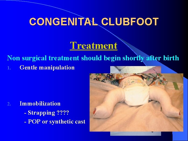 CONGENITAL CLUBFOOT Treatment Non surgical treatment should begin shortly after birth 1. Gentle manipulation