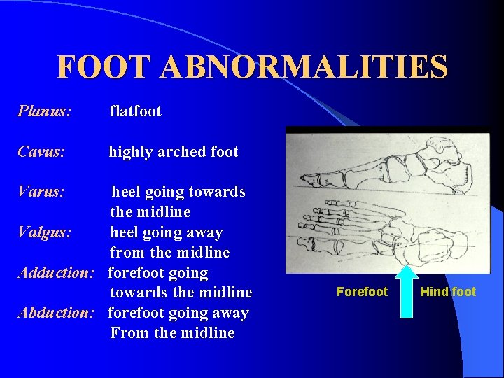 FOOT ABNORMALITIES Planus: flatfoot Cavus: highly arched foot Varus: heel going towards the midline