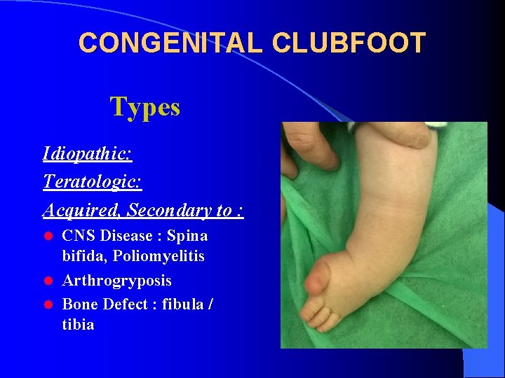 CONGENITAL CLUBFOOT Types Idiopathic: Teratologic: Acquired, Secondary to : CNS Disease : Spina bifida,