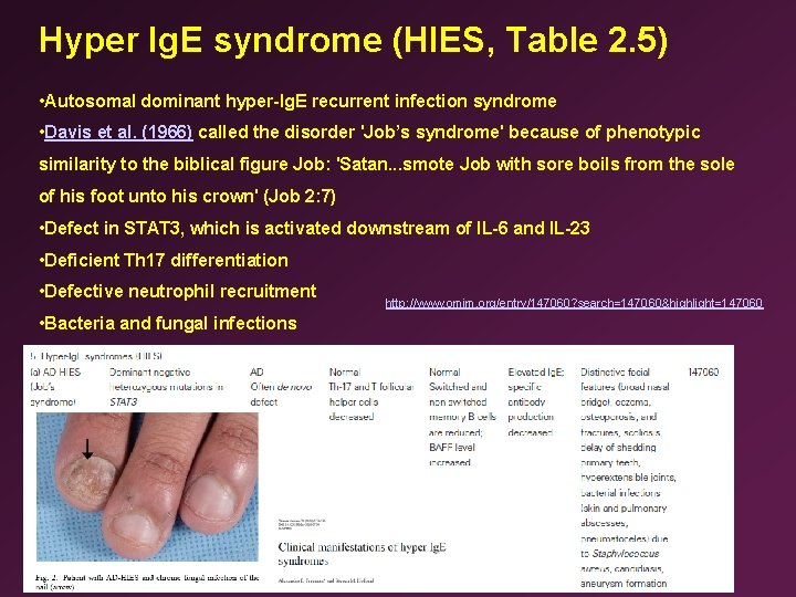 Hyper Ig. E syndrome (HIES, Table 2. 5) • Autosomal dominant hyper-Ig. E recurrent