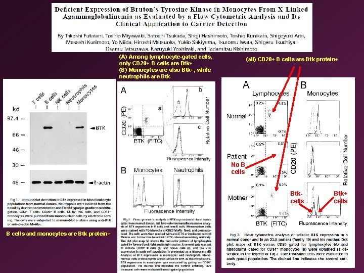 (A) Among lymphocyte-gated cells, only CD 20+ B cells are Btk+ (B) Monocytes are
