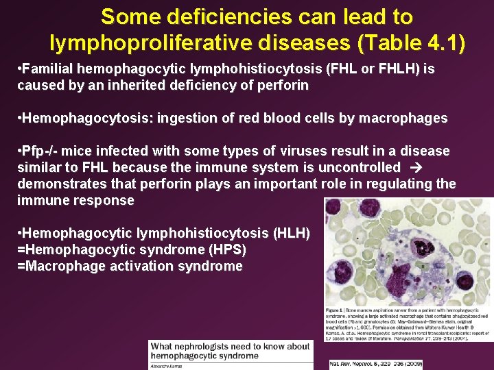 Some deficiencies can lead to lymphoproliferative diseases (Table 4. 1) • Familial hemophagocytic lymphohistiocytosis