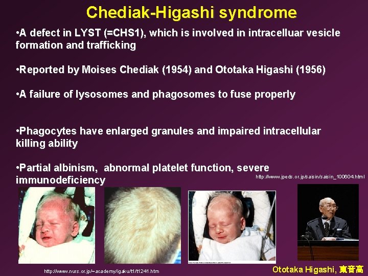 Chediak-Higashi syndrome • A defect in LYST (=CHS 1), which is involved in intracelluar