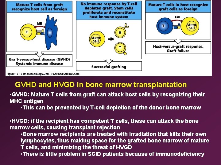 GVHD and HVGD in bone marrow transplantation • GVHD: Mature T cells from graft