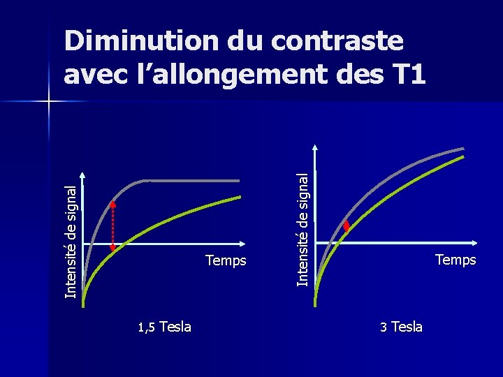 Temps 1, 5 Tesla Intensité de signal Diminution du contraste avec l’allongement des T