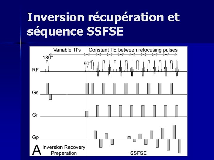 Inversion récupération et séquence SSFSE 