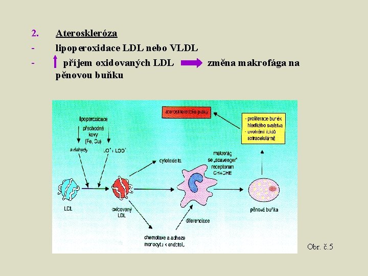 2. - Ateroskleróza lipoperoxidace LDL nebo VLDL příjem oxidovaných LDL změna makrofága na pěnovou
