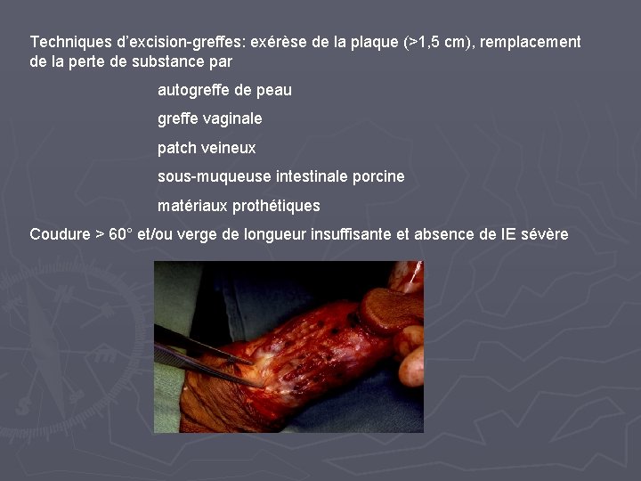 Techniques d’excision-greffes: exérèse de la plaque (>1, 5 cm), remplacement de la perte de