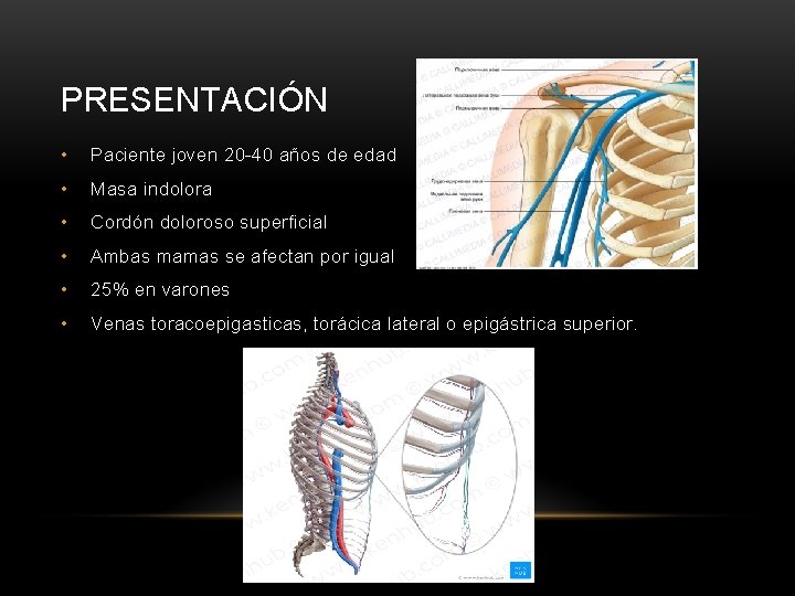 PRESENTACIÓN • Paciente joven 20 -40 años de edad • Masa indolora • Cordón