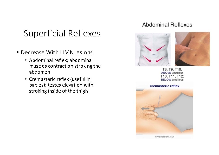 Superficial Reflexes • Decrease With UMN lesions • Abdominal reflex; abdominal muscles contract on