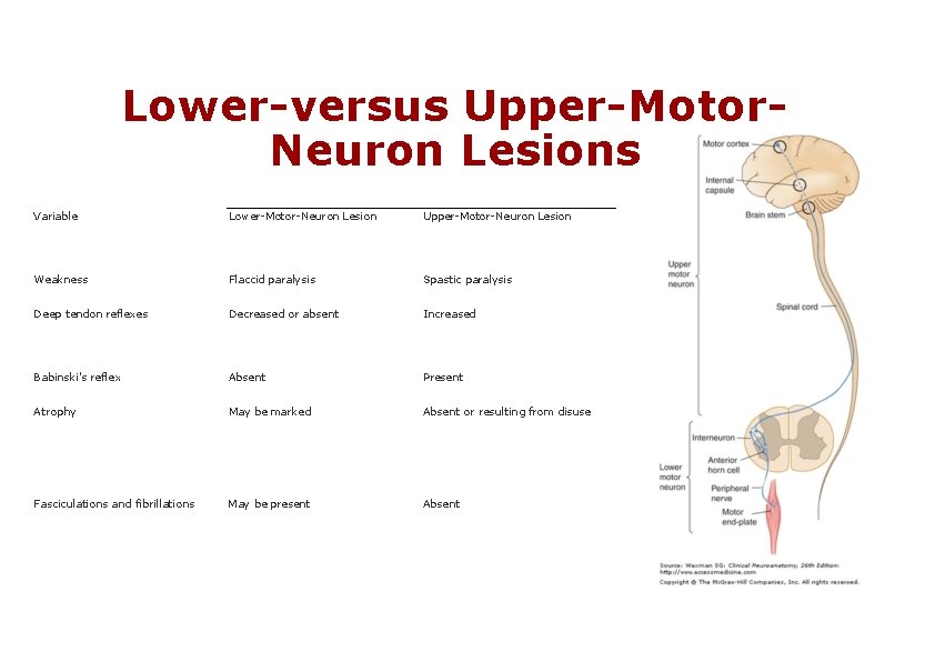 Lower-versus Upper-Motor. Neuron Lesions Variable Lower-Motor-Neuron Lesion Upper-Motor-Neuron Lesion Weakness Flaccid paralysis Spastic paralysis