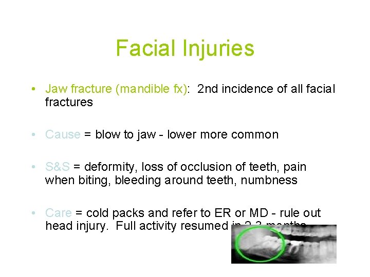 Facial Injuries • Jaw fracture (mandible fx): 2 nd incidence of all facial fractures