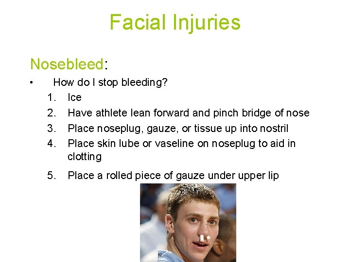 Facial Injuries Nosebleed: • How do I stop bleeding? 1. Ice 2. Have athlete