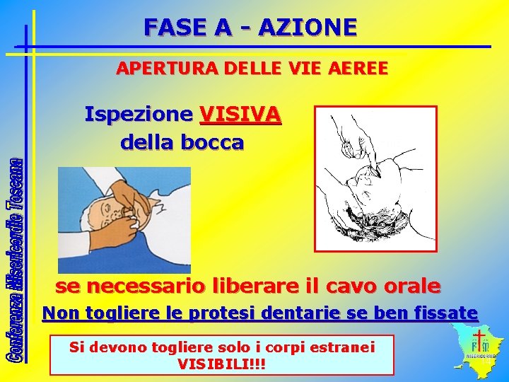 FASE A - AZIONE APERTURA DELLE VIE AEREE Ispezione VISIVA della bocca se necessario