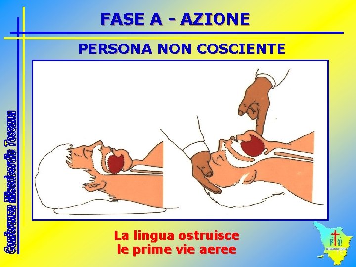 FASE A - AZIONE PERSONA NON COSCIENTE La lingua ostruisce le prime vie aeree