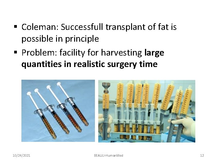 § Coleman: Successfull transplant of fat is possible in principle § Problem: facility for