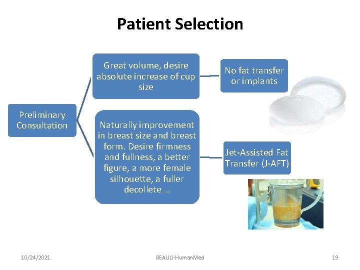 Patient Selection Preliminary Consultation 10/24/2021 Great volume, desire absolute increase of cup size No