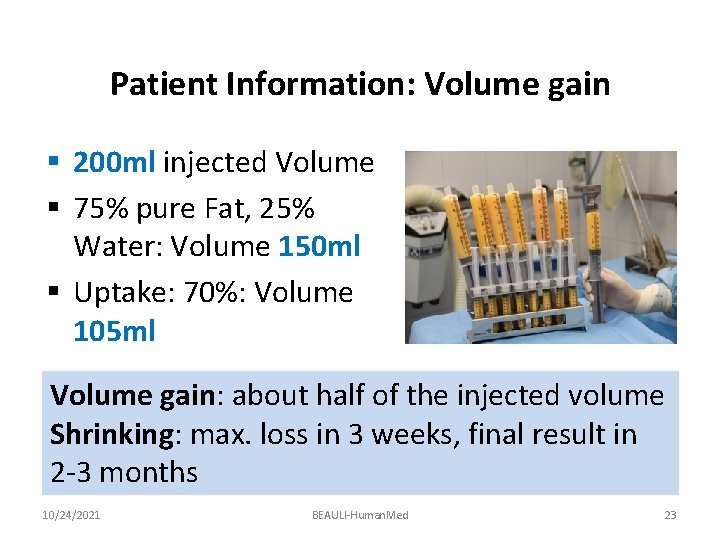 Patient Information: Volume gain § 200 ml injected Volume § 75% pure Fat, 25%