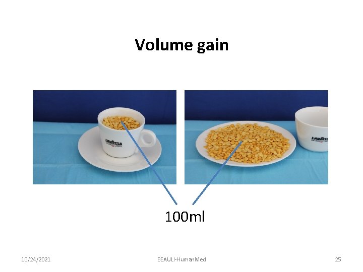 Volume gain 100 ml 10/24/2021 BEAULI-Human. Med 25 